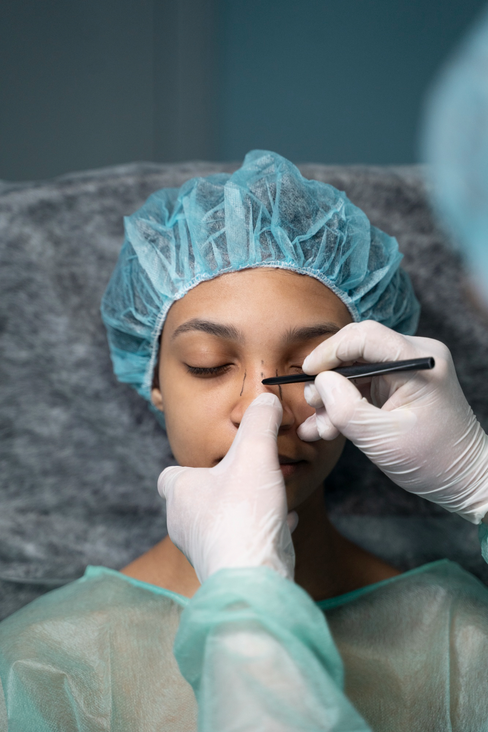 Best Nose Fillers Surgeon in Dubai