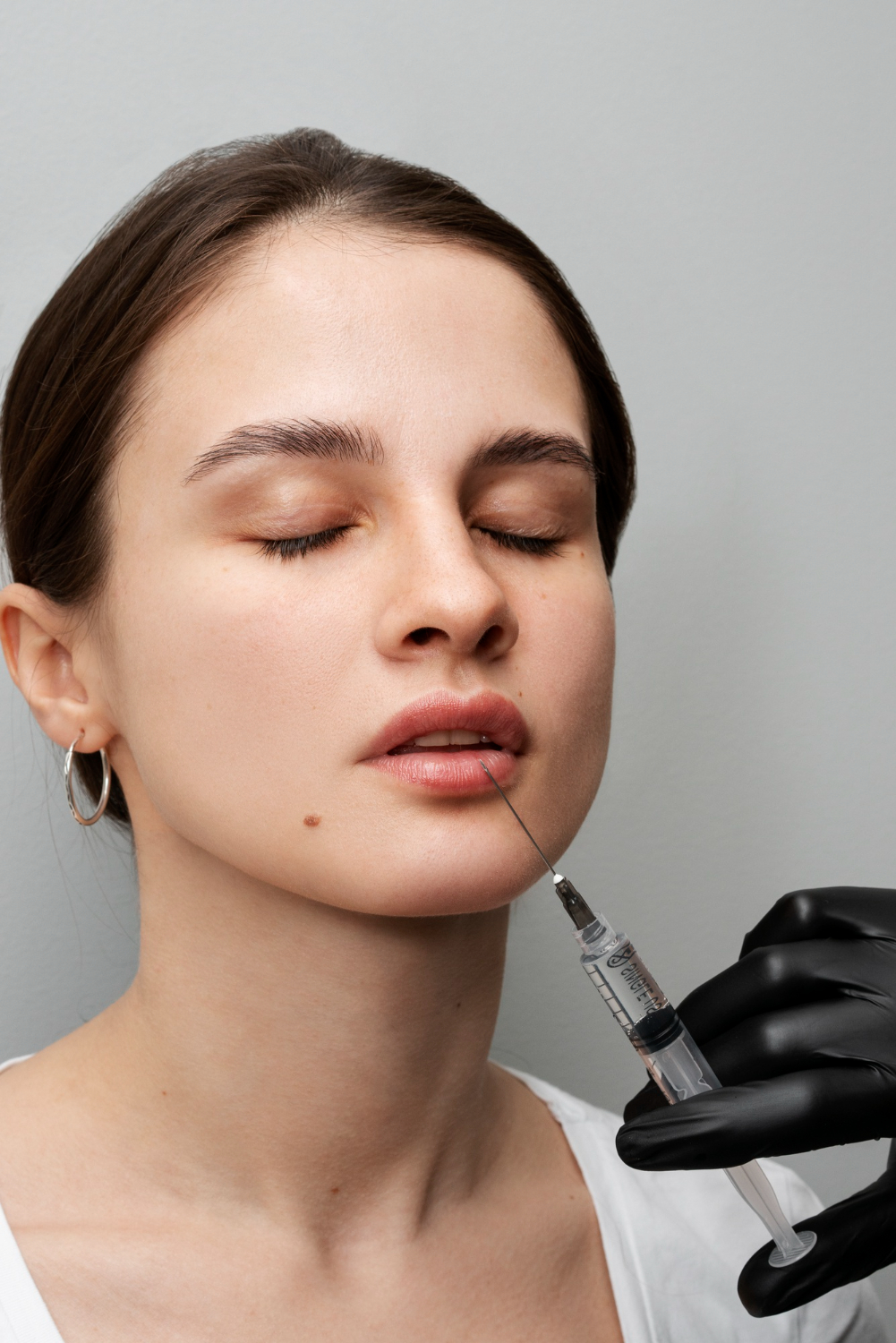 Russian Lip Fillers Injections in Dubai
