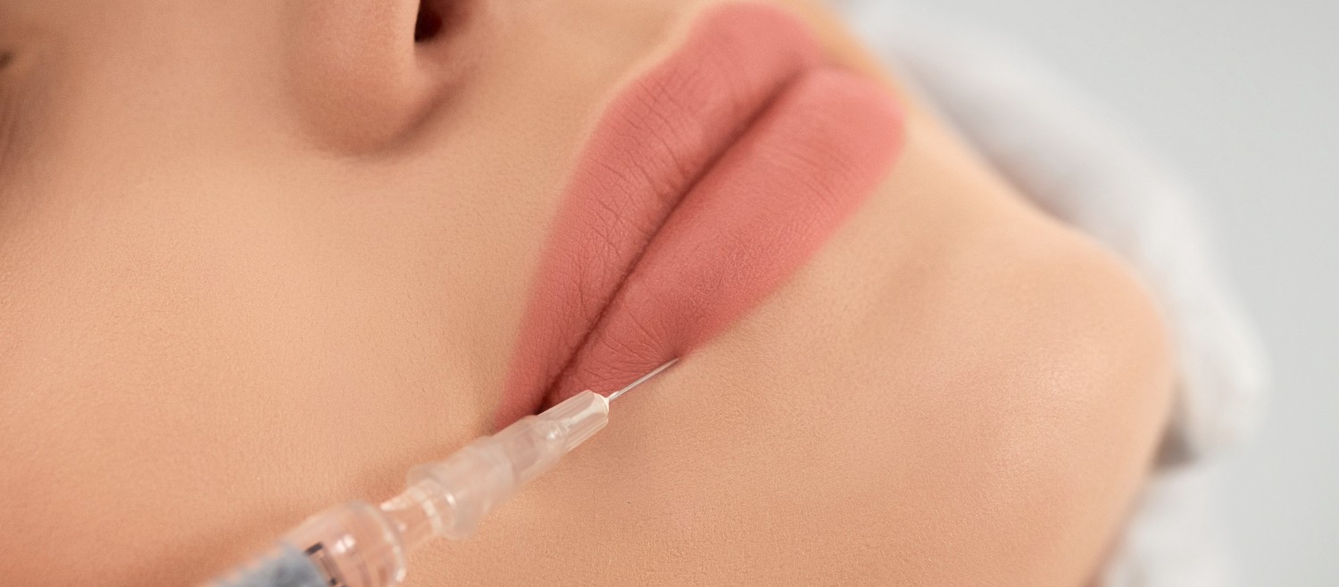 Get The Russian Lips With Lip Filler Dubai