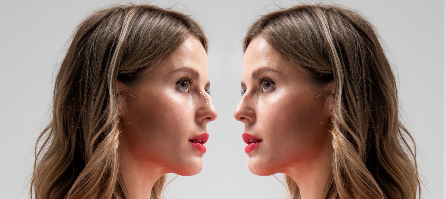 Non-Surgical Options For Natural Nose Job Results