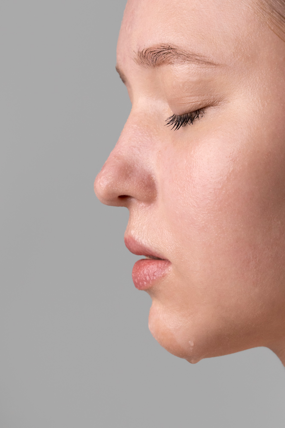 Open Rhinoplasty Surgery in Dubai