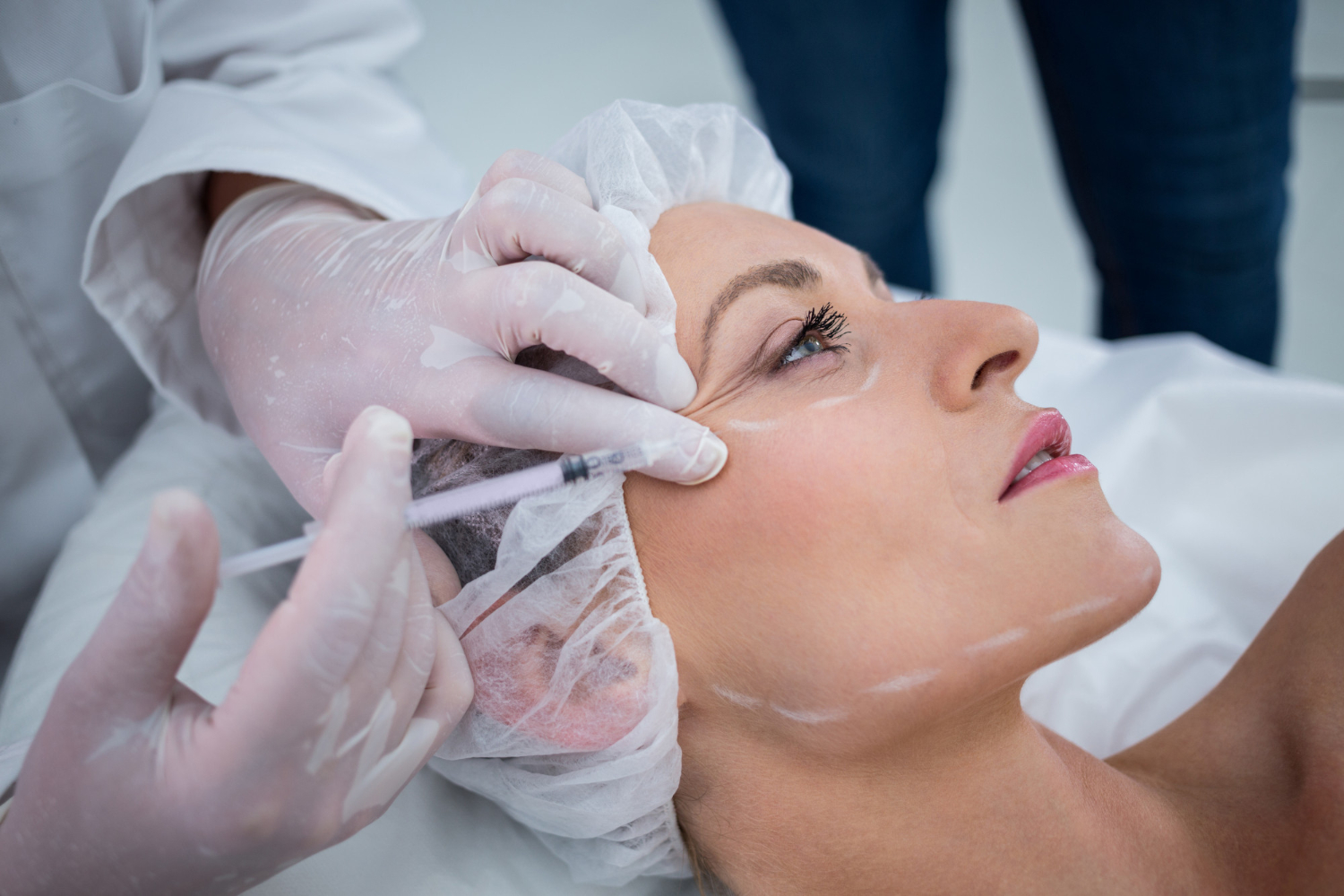 Comparing Different Types Of Facial Fillers